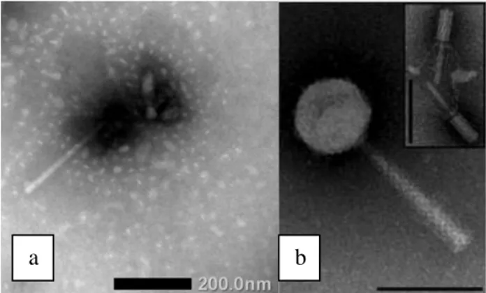 Gambar 3. Kenampakan morfologi bakteriofag. (a) yang  menginfeksi bakteri R. solanacearum dengan menggunakan 