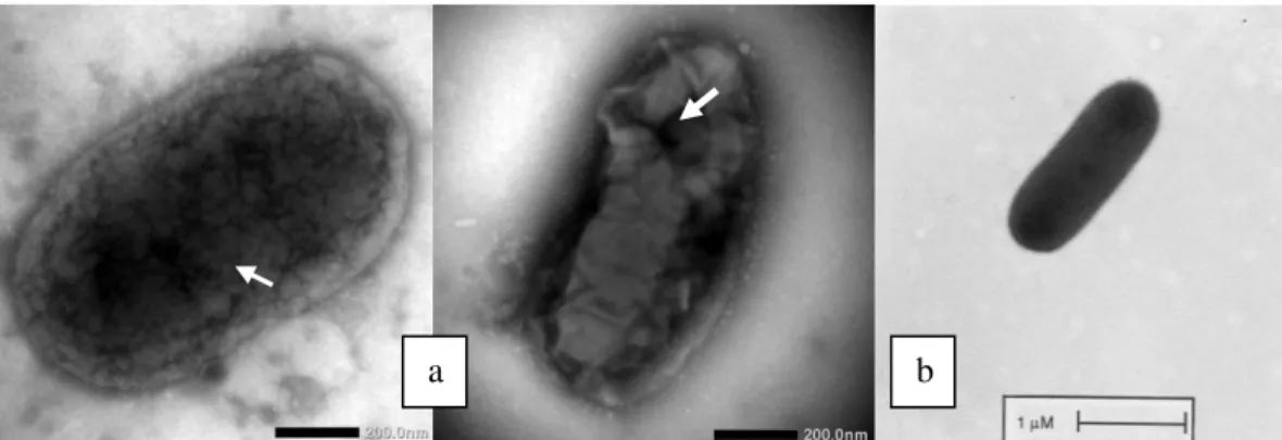 Gambar 4. Kenampakan Morfologi; a. Sel Bakteri R. solanacearum yang lisis (anak  panah) dengan Manggunakan TEM, b