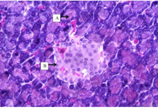 Gambar  4.  Histopatologi  pankreas  tikus  hiperglikemia  dengan  pelakuan  ETKBP  dosis150  mg/kg  BB  perbesaran  400  X