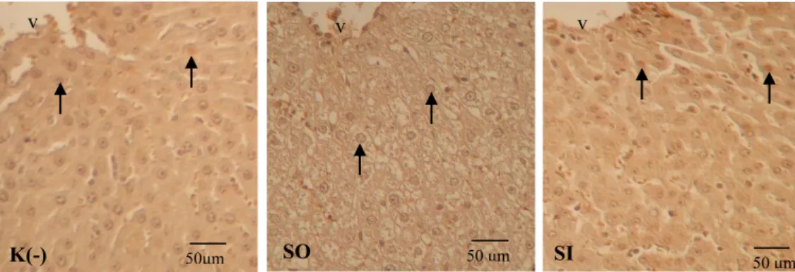 Gambar 2.  Fotomikrograf  jaringan  hati  tikus  perlakuan  yang  diwarnai  secara  imunohistokimia  terhadap  Cu,Zn-SOD