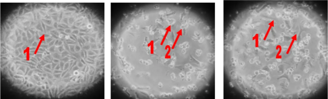Gambar 1.  Morfologi  sel  kanker  payudara  setelah  inkubasi  selama  24  jam.  Kontrol  sel  T47D  (A);  Doksorubisin  konsentrasi  250  nM  (B);  Ekstrak  Metanol  Daun  Kenikir  konsentrasi 1.000 µg/mL (C)