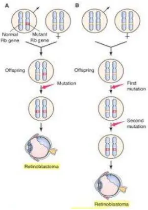 Gambar 2.8. Patogenesis mutasi gen RB1 sel germinal dan sel non-