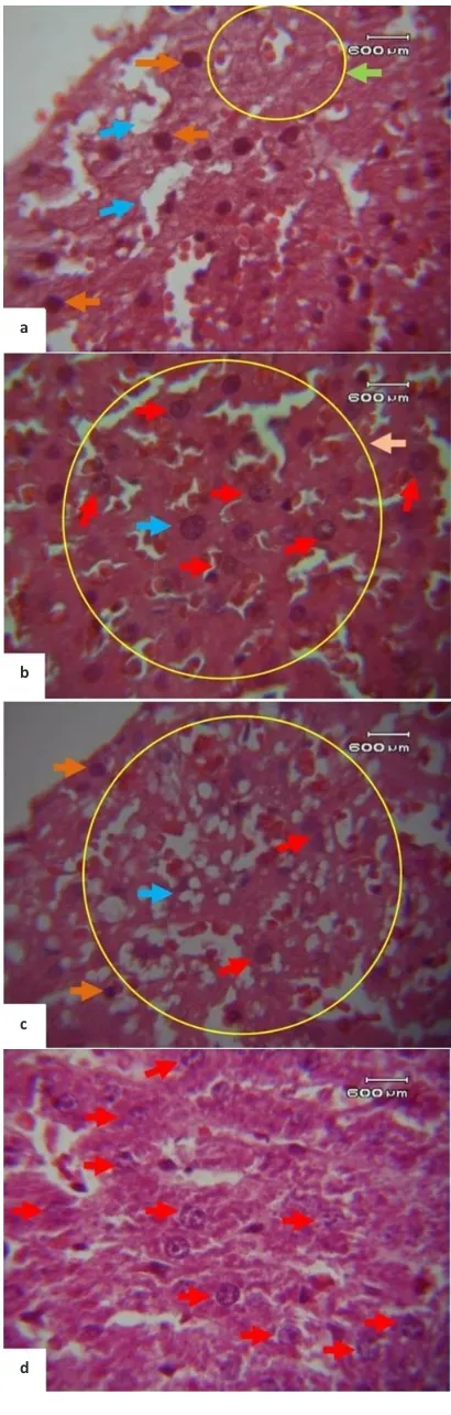 Gambar 1. Gambar histopatologi sel hepar tikus perbesaran 1000x dengan pewarnaan HE
