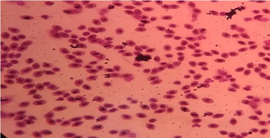 Gambar 3. Diferensiasi Leukosit 30 Hari pemeliharaan dengan Perlakuan P3  Jumlah  sel  limfosit  ikan  nila  salin 