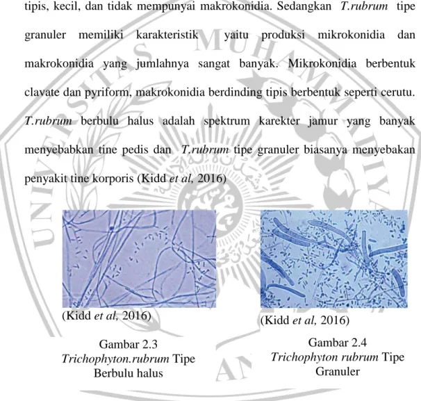 Gambar 2.4   Trichophyton rubrum Tipe 