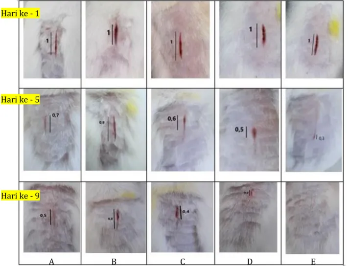 Gambar 2. Ulkus Diabetikum hari ke-1, hari ke-5 dan hari ke-9 Hari ke - 1 