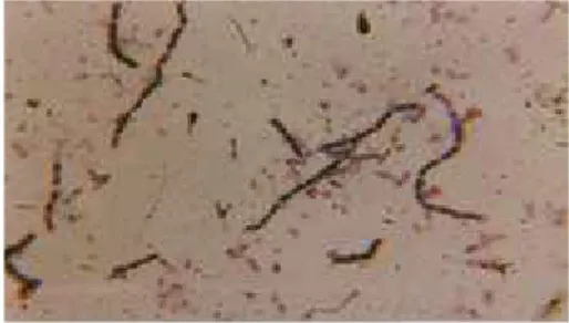 Gambar 4. Bentuk koloni bakteri Desulfomaculum perbesaran 400x 