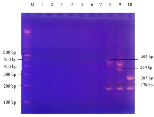 Gambar 1.   Hasil elekroforesis dari produk amplikon multiplek PCR dengan primer  AMOS + RB51 + eri  untuk sampel nomer 18.