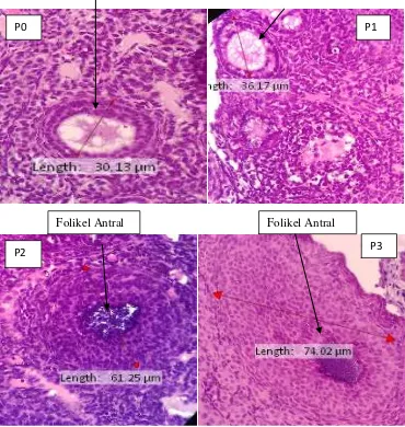 Gambar 5.2 Histologi Ovarium Kanan Mencit Pengecatan HE Pembesaran 400 x P0: kelompok kontrol, P1: konsentrasi 10%, P2: konsentrasi 20% , P3: konsentrasi 30%