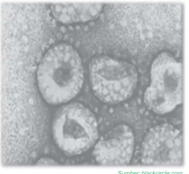 Gambar 1.4Virus Sars