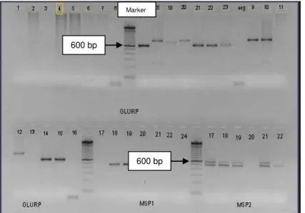 Gambar 2. Hasil Amplifikasi P. falciparum Lokus Gen GLURP  pada Penderita Malaria di Kalimantan dan Sulawesi  
