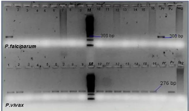 Gambar  1.  Visualisasi  Pita  DNA  dari  Parasit  Malaria  Melalui  Elektroforesis  Sumur  1-16  adalah  Sampel  (Sumur  Atas  Menujukkan  Pf  dan  Bawah  Menunjukkan  Pv),  M=  