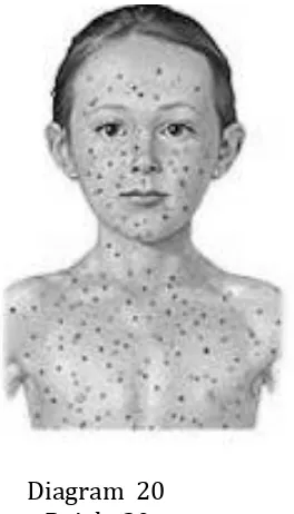 Gambar  20 menunjukkan keadaan penyakit yang dihadapi oleh seorang budak  