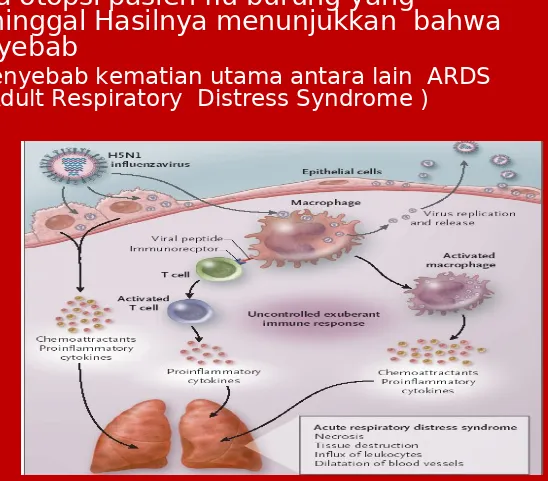 Gambar 4 Acut Respiratory distress syndrome