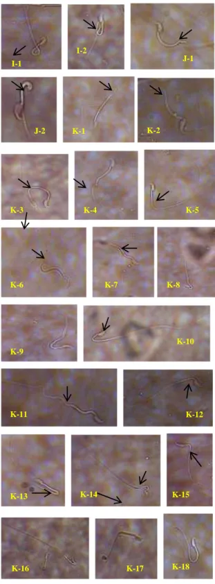 Gambar 4.1 Macam-Macam Morfologi Spermatozoa Mencit    