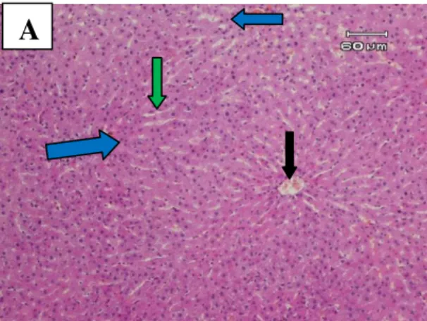 Gambar  1A.  Gambaran  mikroskopik  hati  tikus  wistar  kelompok  A  (kontrol  negatif)