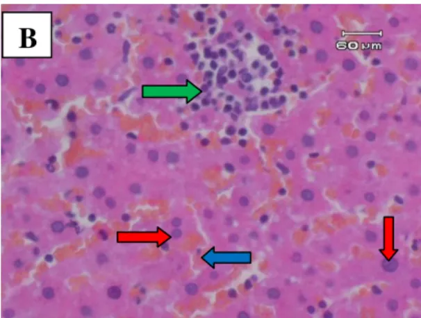 Gambar  2B.  Gambaran  mikroskopik  hati  tikus  kelompok  B  (perlakuan  1).  Tampak  gambaran  hati  tidak  normal  dengan  adanya  sel  radang  (panah  merah)