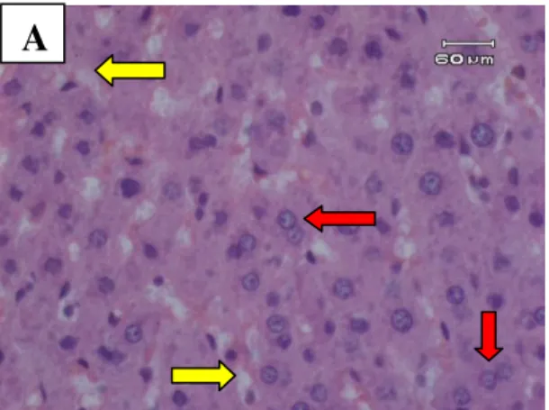 Gambar  4B.  Gambaran  mikroskopik  hati  tikus  kelompok  D  (perlakuan  3).  Tampak  adanya  gambaran  sel  hati  yang  mengalami  regenerasi  (panah  merah)  dan  masih  ada  perlemakan  hati  (panah kuning)
