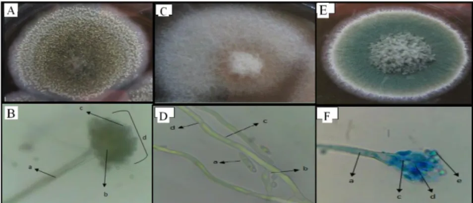 Gambar  2.  Pengamatan  koloni  kapang  (A).  makroskopik  kapang  Aspergillus,    (B)  mikroskopik  kapang  Aspergillus  perbesaran  1000x  (a=  konidiofor,  b=  vesikel,  c=  konidia,  d=  kepala  konidia),  (C)  makroskopik  kapang  Fusarium  sp.,  (D) 