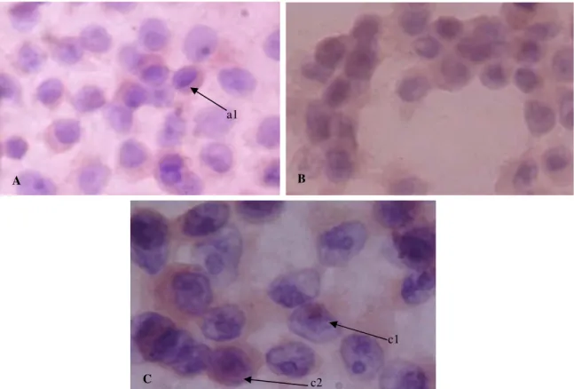 Gambar 2. Ekspresi p21 sel MCF-7. A. Kontrol sel. a1. p21 terekspresi pada sitoplasma