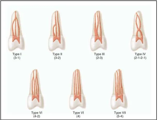 Gambar 6. Klasifikasi saluran akar menurut Gulabivala11
