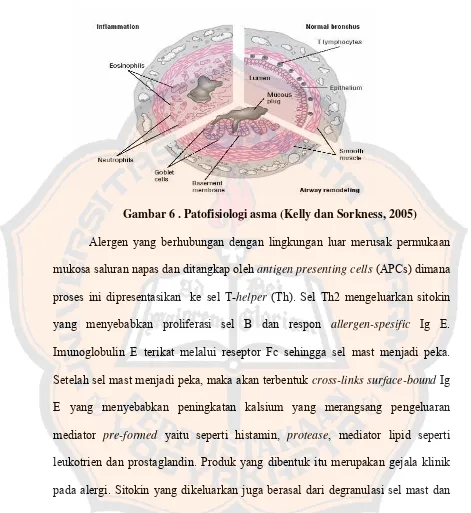 Gambar 6 . Patofisiologi asma (Kelly dan Sorkness, 2005) 