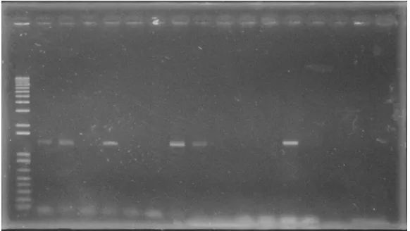 Gambar 5. Hasil PCR 16s rRNA 