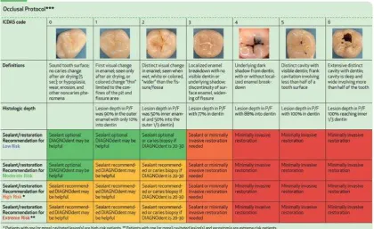 Tabel 2, Kode ICDAS, http://www.icdas.org/clinical-practice.17 