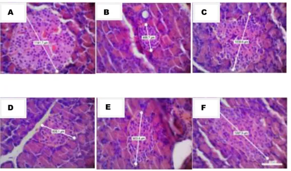 Gambar 4. Insula Pankretika Pankreas dengan pewarnaan HE model tikus Diabetes Melitus