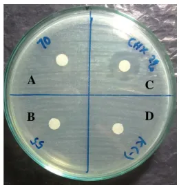 Gambar 1. Gambaran Diameter Zona Hambatan Bakteri  Enterococcus faecalis. (A) Zona Hambatan KBM 70% 