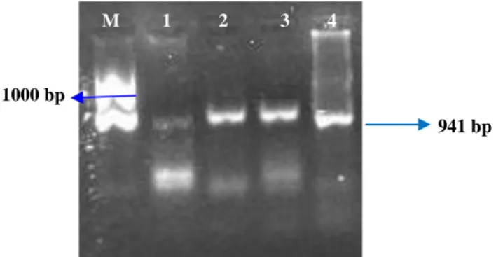 Gambar 2. Elektroforesis DNA Perlakuan A 