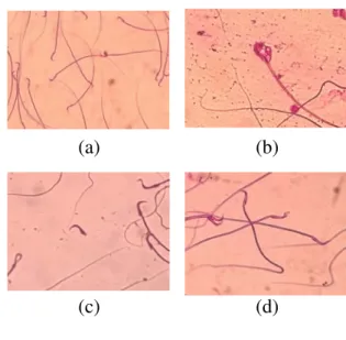 Tabel  1.  Rerata  Konsentrasi  Spermatozoa  Tikus   Kelompok Sampel  Rerata Konsentrasi Spermatozoa (x106  /  ml)  Kontrol (P 0 )  ± 42  Perlakuan (P 1 )  ± 47  Perlakuan (P 2)  ± 46 