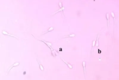 Tabel 4.  Persentase  abnormalitas  spermatozoa  Kambing  PE  setelah  pengenceran  dengan Ringer’s Dextrose dan ekstrak bawang merah 