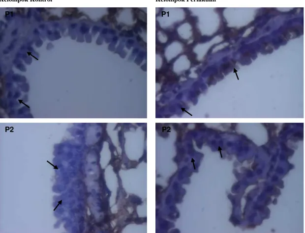 Gambar 1. Lokasi  imunohistokimia  sel  jaringan  paru  yang diinduksi  B(a)P  yang  terekspresi  protein  Bax  pada  kelompok  kontrol karsinogen (A, B) dan kelompok perlakuan (C, D)