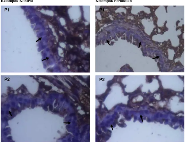 Gambar 3. Lokasi  imunohistokimia  sel  jaringan  paru  yang  diinduksi  B(a)P  yang  terekspresi  protein  Bcl-2  pada  kelompok  kontrol karsinogen (A, B) dan kelompok perlakuan (C, D)