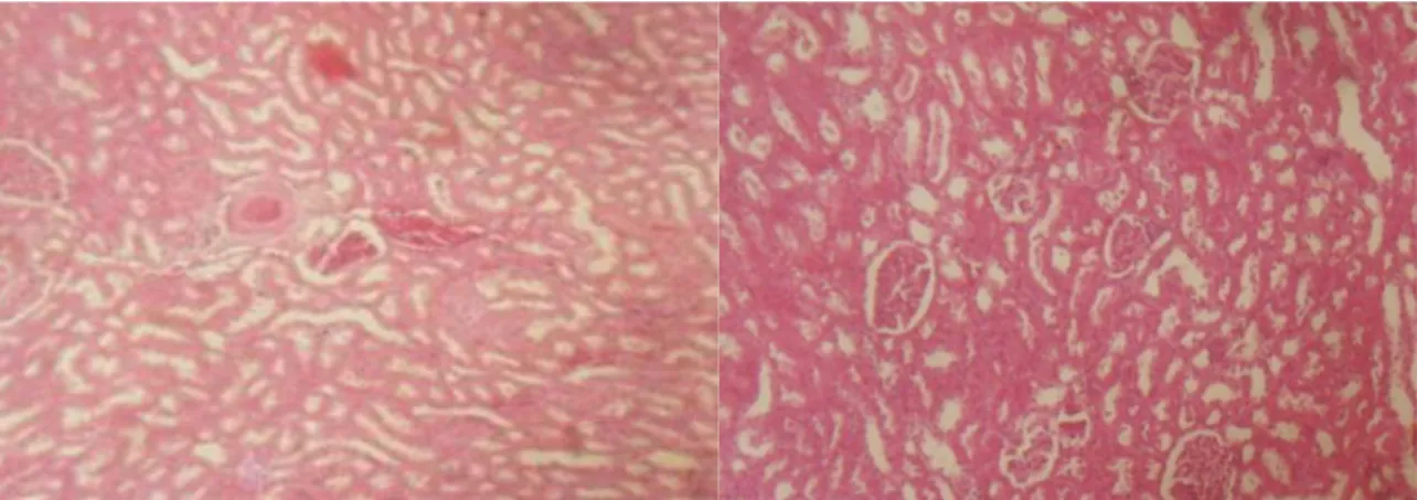 Gambar 1.  Mikrograf  ginjal  tikus.  K2  (kiri):  Struktur  glomerulus  membengkak,  hiperemi,  hemoragi,  struktur tubulus membengkak karena terjadinya degenerasi melemak dan cloudy swelling pada  sel-sel tubulus sehingga lumen tubulus menyempit