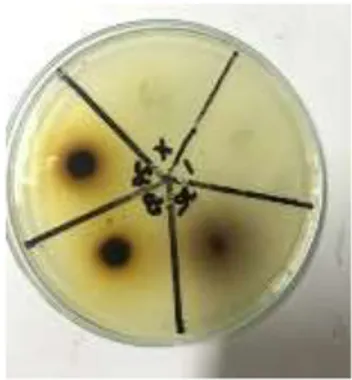 Gambar 1. Aktifitas daya hambat ekstrak  binahong terhadap isolat bakteri E. coli  Tabel 1