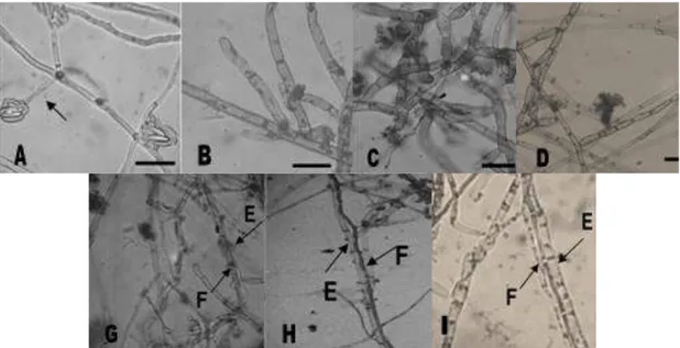 Gambar 3.   Struktur  mikroskopis  fungi.  A.  Struktur  mikroskopis  F.  oxysporum    B