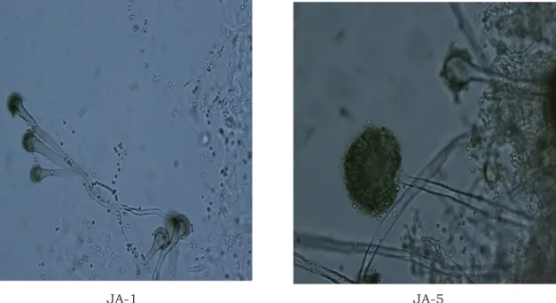 Gambar 2. Dua isolat yang memiliki karakter genus Aspergillus (perbesaran 1000x ) Figure  2