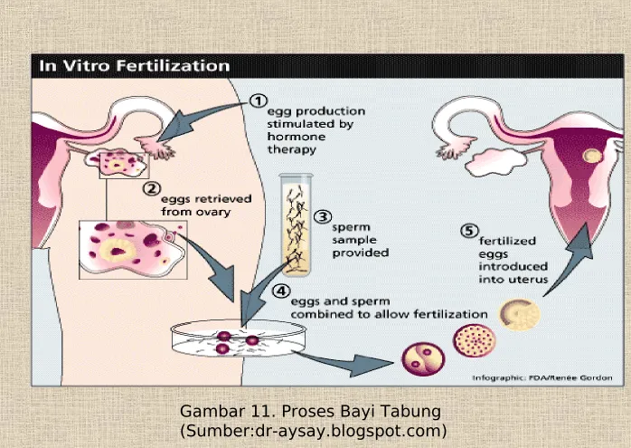 Gambar 11. Proses Bayi Tabung