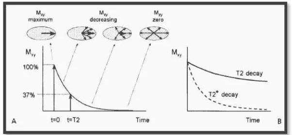 Gambar 2.7 A.Relaksasi T2 dan B. Waktu peluruhanT2 