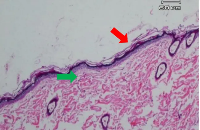 Gambar  8a.  Penyembuhan  luka  yang  tidak  diberi  getah bonggol pisang hari ke-14. Terlihat angiogenesis  (panah hitam), fibroblas (panah biru)