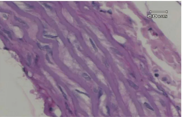 Gambar  1.Gambaran mikroskopik tanpa  pemberian diet pelet margarin pada aorta tikus  wistar kelompok negatif dengan pembesaran 40  X 10