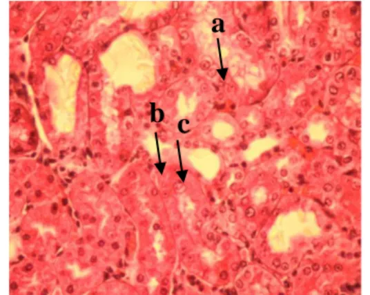 Gambar  2. a. Glomerulus yang ada pada nefron ginjal  (tempat penyaringan darah), terlihat dalam keadaan 