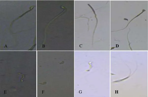 Gambar 2 Morfologi Spermatozoa Normal dan Abnormal Mencit yang Diberi Perlakuan   Ekstrak Teh Hitam