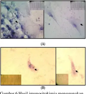 Gambar 6 Hasil imunositokimia menggunakan Anti Mouse TNF-a pada kultur sel trofoblas (Diamati pada mikroskop cahaya dengan perbesaran 400X) (A) tanpa glukosa 33 mM (B) dengan glukosa 33 mM