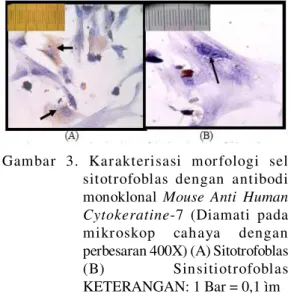 Gambar  2.  Morfologi  kultur  eksplan  trofoblas plasenta  manusia  (Diamati  pada mikroskop  fase  kontras  dengan per besar an  200X)  setelah diinkubasi selama 1 jam (Black et al.,  2003)