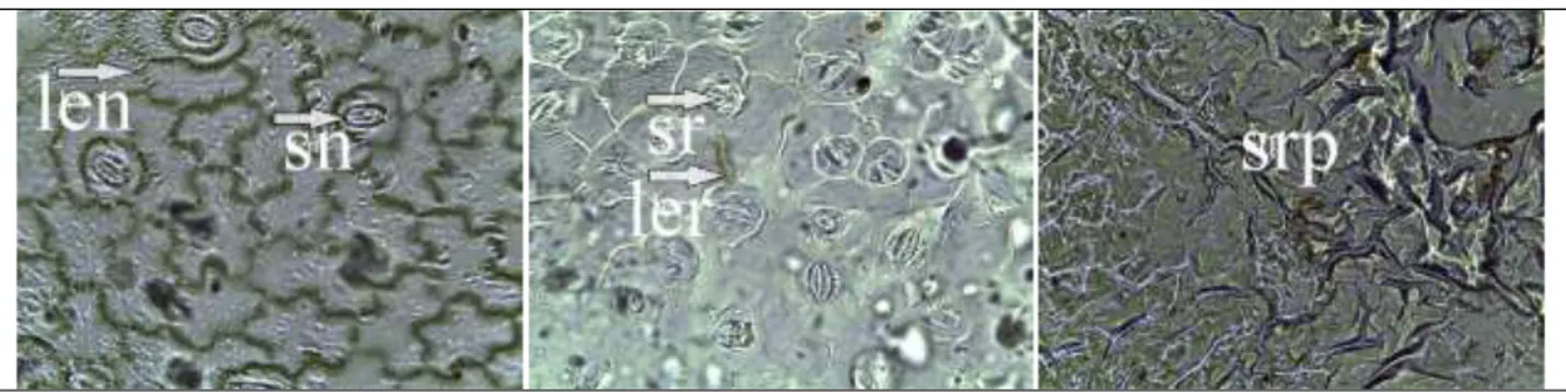Gambar 3.    Jaringan epidermis bawah daun gulma Asystasia gengetica  yang diaplikasi kombinasi asam  asetat dan ekstrak buah lerak dengan pembesaran mikroskop 100 x 10 m 