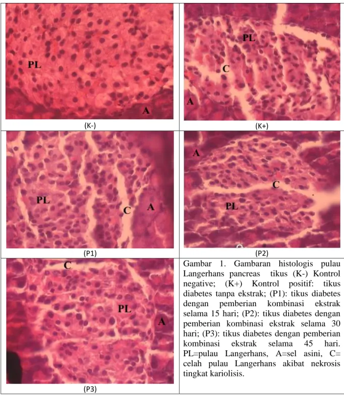 Gambar  1.  Gambaran  histologis  pulau  Langerhans  pancreas    tikus  (K-)  Kontrol  negative;  (K+)  Kontrol  positif:  tikus  diabetes  tanpa  ekstrak;  (P1):  tikus  diabetes  dengan  pemberian  kombinasi  ekstrak  selama  15  hari;  (P2):  tikus  dia