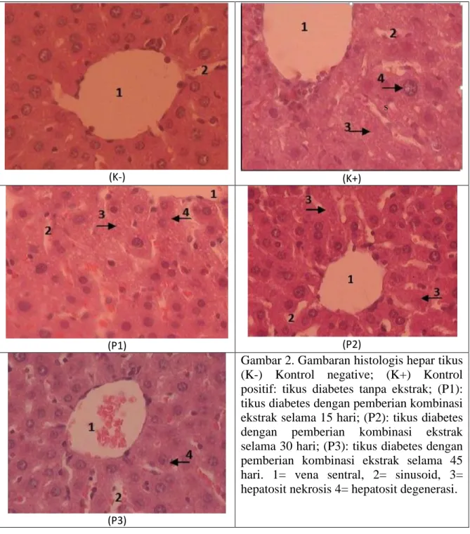 Gambar 2. Gambaran histologis hepar tikus  (K-)  Kontrol  negative;  (K+)  Kontrol  positif:  tikus  diabetes  tanpa  ekstrak;  (P1): 